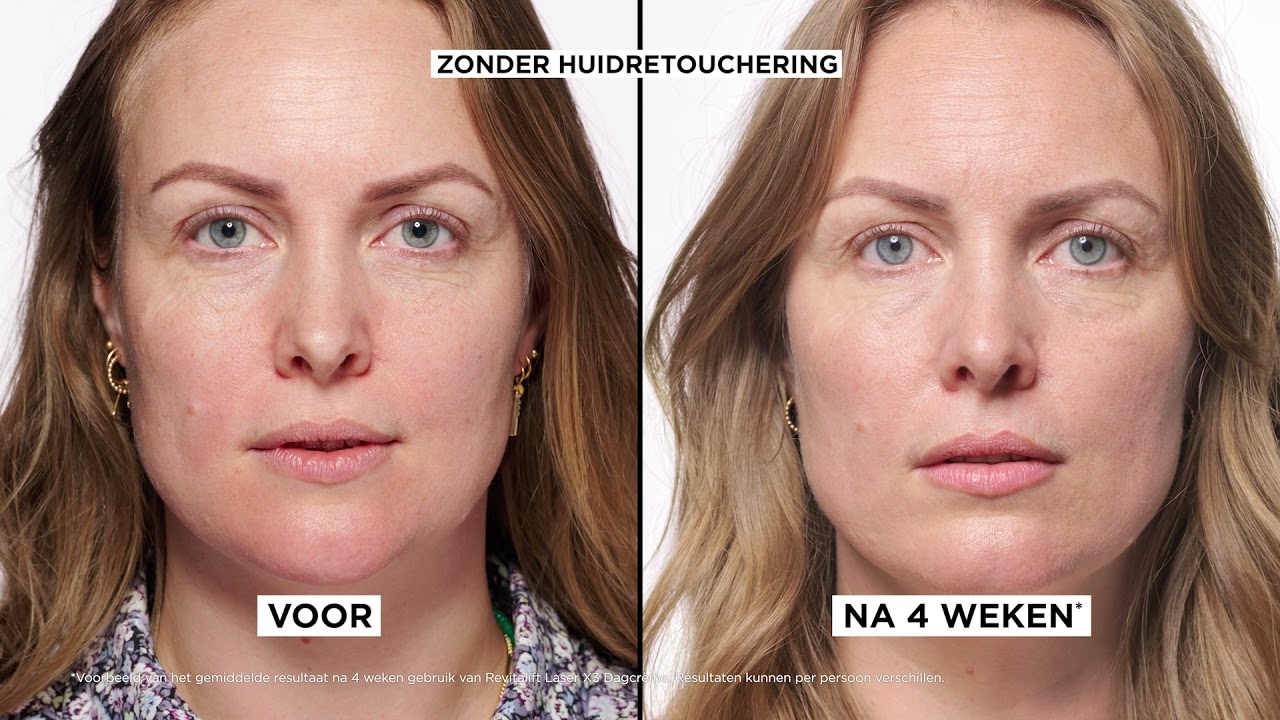 L’Oréal Paris: Revitalift Laser X3 doet wat het belooft